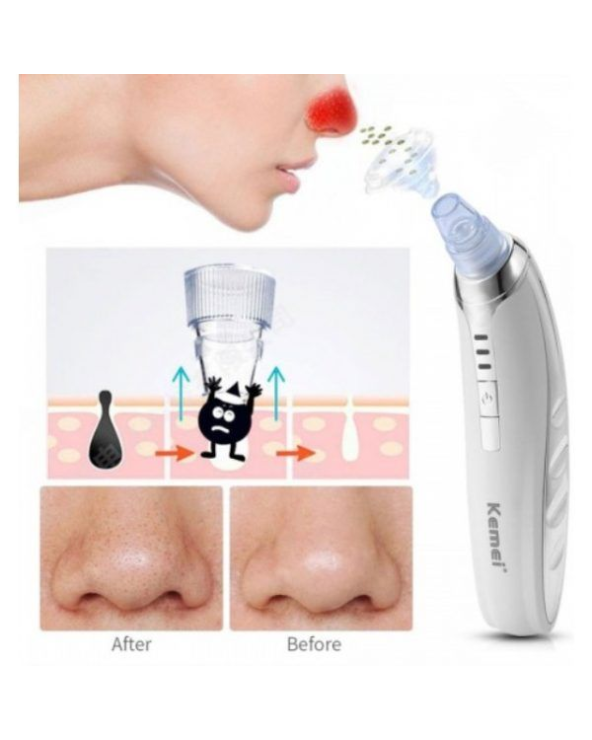 Συσκευή για βαθύ καθαρισμό προσώπου - KM-1868 - Kemei