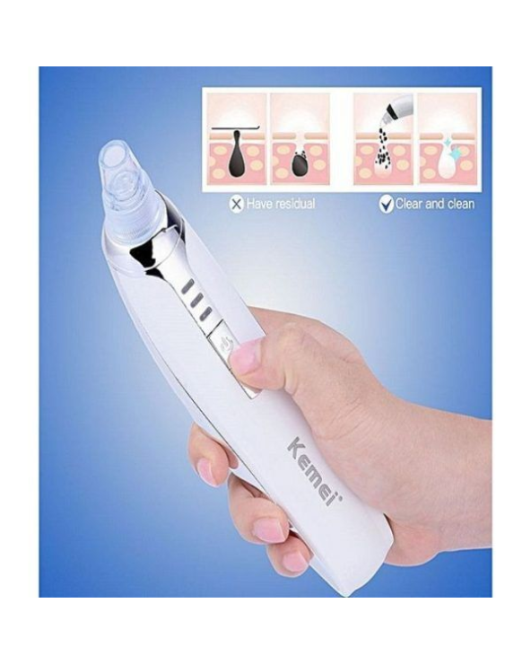 Συσκευή για βαθύ καθαρισμό προσώπου - KM-1868 - Kemei